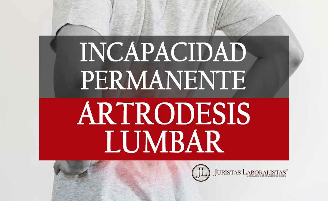 incapacidad-permanente-por-artrodesis-lumbar